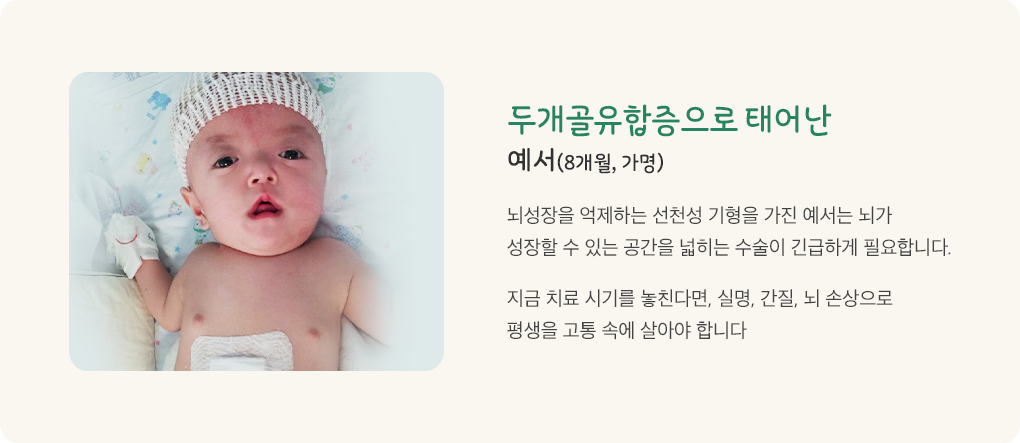 두개골유합증으로 태어난 예서 8개월 가명. 뇌성장을 억제하는 선천성 기형을 가진 예서는 뇌가 성장할 수 있는 공간을 넓히는 수술이 긴급하게 필요합니다. 지금 치료 시기를 놓친다면 실명 간질 뇌 손상으로 평생을 고통 속에 살아야 합니다.