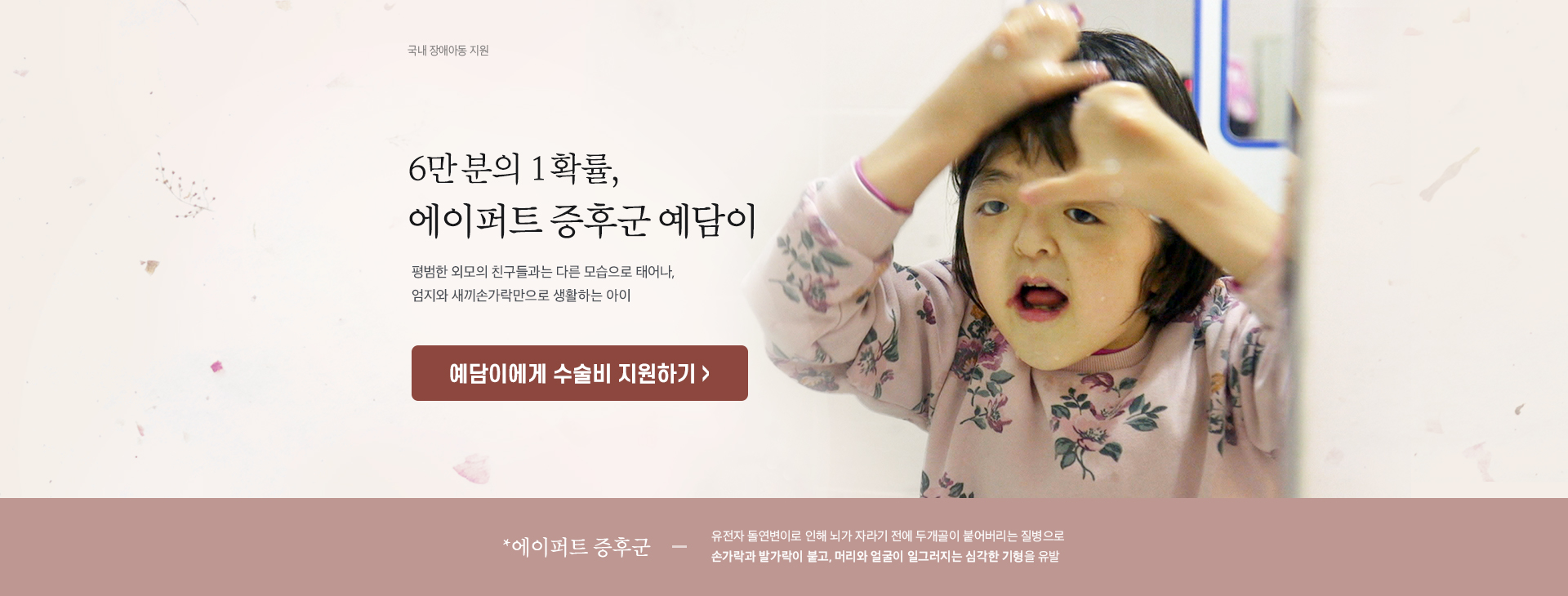 6만 분의 1확률 에이퍼트 증후군 예담이