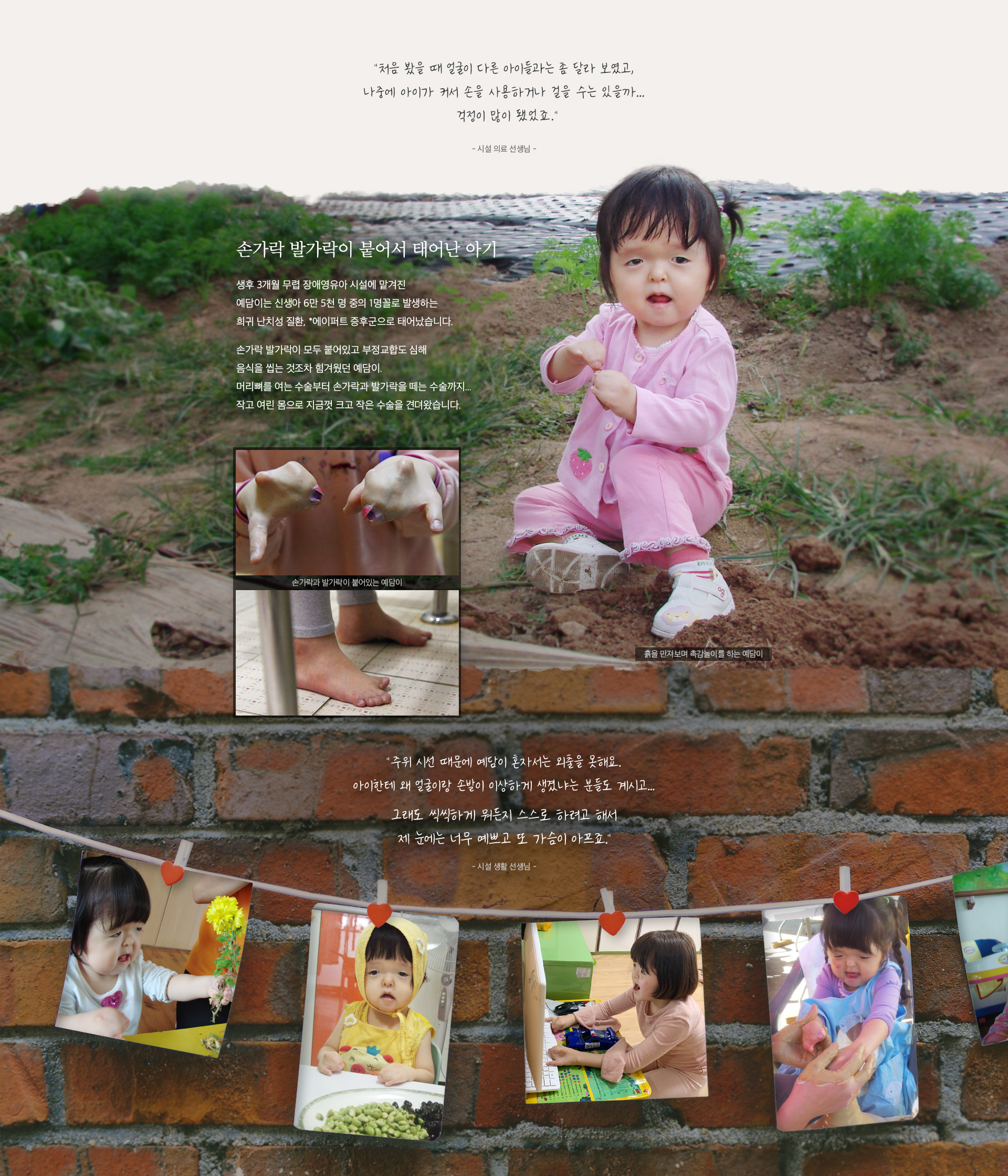 에이퍼트 증후군. 유전자 돌연변이로 인해 뇌가 자라기 전에 두개골이 붙어버리는 질병으로 손가락과 발가락이 붙고 머리와 얼굴이 일그러지는 심각한 기형을 유발. 생후 3개월 무렵 장애영유아 시설에 맡겨진 예담이는 신생아 6만 5천 명 중의 1명꼴로 발생하는 희귀 난치성 질환 에이퍼트 증후군으로 태어났습니다.