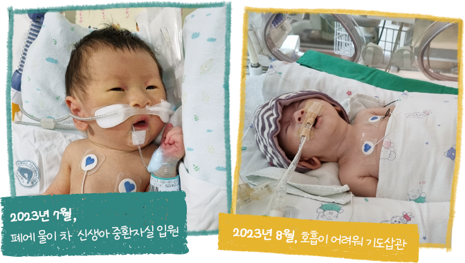 2023. 07폐에 물이 차 신생아 중환자실 입원, 2023. 08호흡이 어려워 기도삽관
