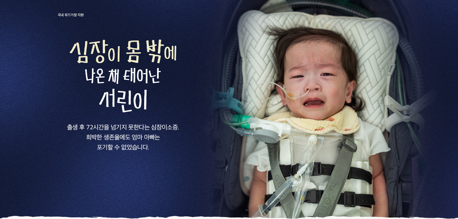 심장이 몸 밖에 나온 채 태어난 서린이