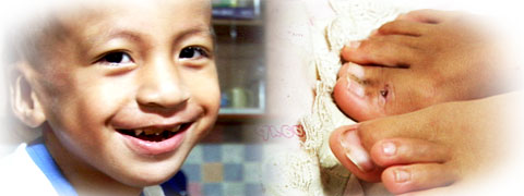 다지증 앓는 김가훈 군 사연 <CBS 수호천사> 방영