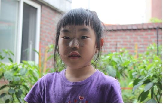 위제너레이션, 밀알복지재단과 함께 장애아동 수술비 모금 진행